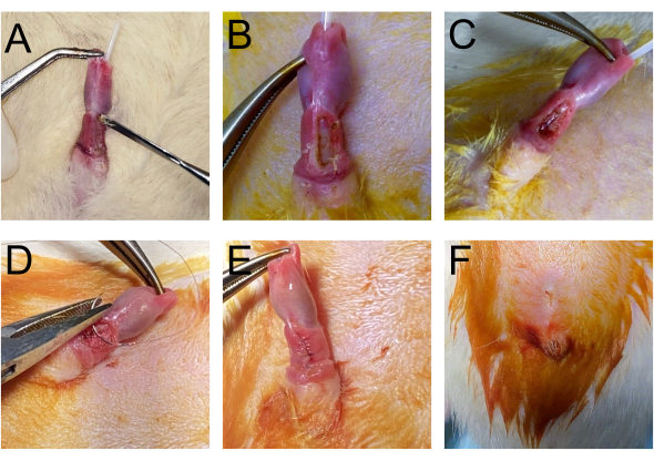 Surgical procedure steps in wound healing; six-panel diagram; tissue manipulation and suturing.