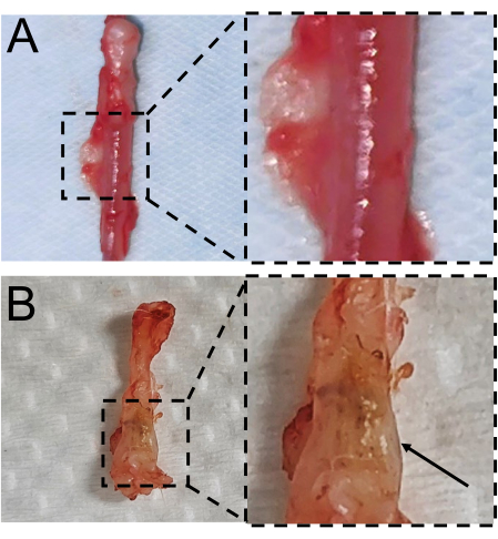 Tissue sample microscopy, magnified view, biological examination, cellular structure analysis.