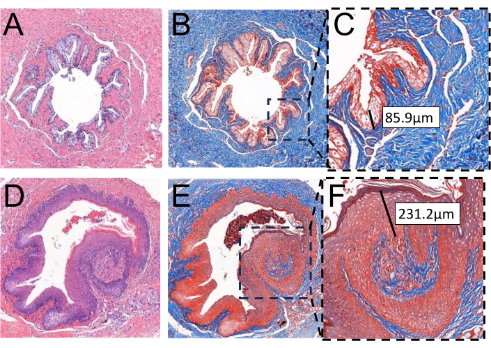 Histology of vascular tissue sections; stained, labeled images A-F; thickness measured in micrometers.