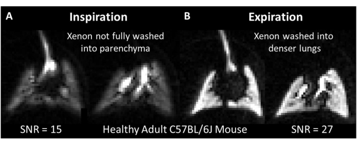 figure-results-1 MRI imaging of mouse lungs showing xenon gas distribution during inspiration and expiration.