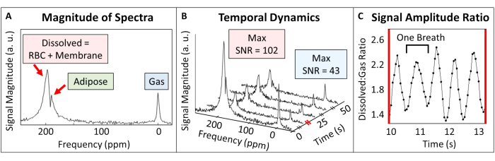 figure-results-2 Spectra analysis; dissolved gas, adipose, RBC; signal dynamics, amplitude ratio; graph.