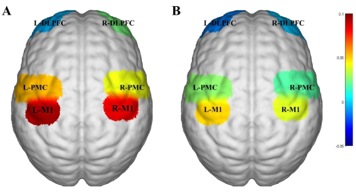 figure-results-2 Brain activation map; diagram comparing left and right motor cortex activity; fMRI result analysis.