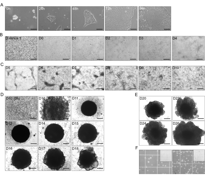figure-results-1 Cell growth time series in culture; microscope images; stages from 0h to D26; cell morphology evolution.