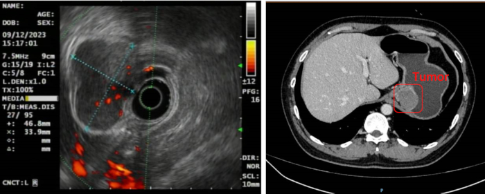 Ultrasound and CT scan images, tumor detection, diagnostic imaging, cross-sectional analysis.