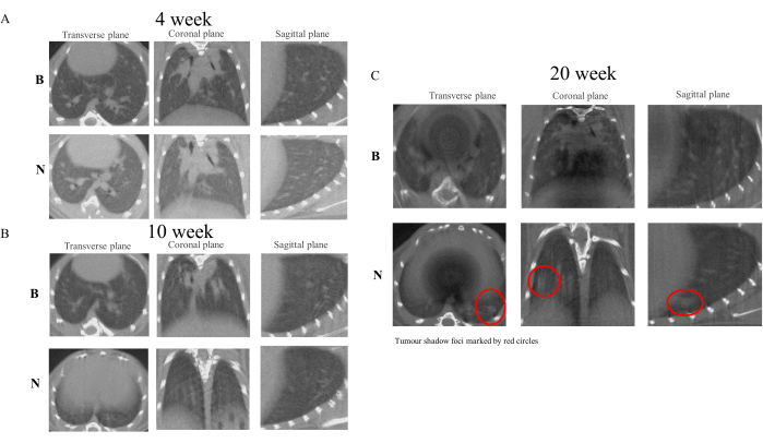 figure-results-4 CT scan analysis, tumor progression over weeks, transverse/coronal/sagittal planes, medical imaging.