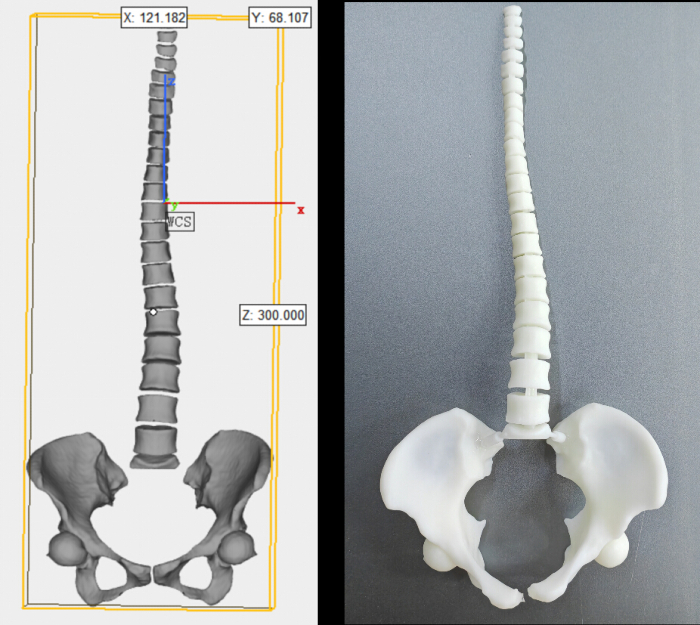 3D spinal model comparison; digital diagram and physical replica for anatomical analysis.