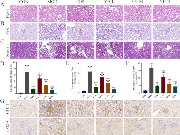 figure-results-2 Histology staining comparison; H&E, PAS, Masson images and fibrosis data in kidney tissue analysis.
