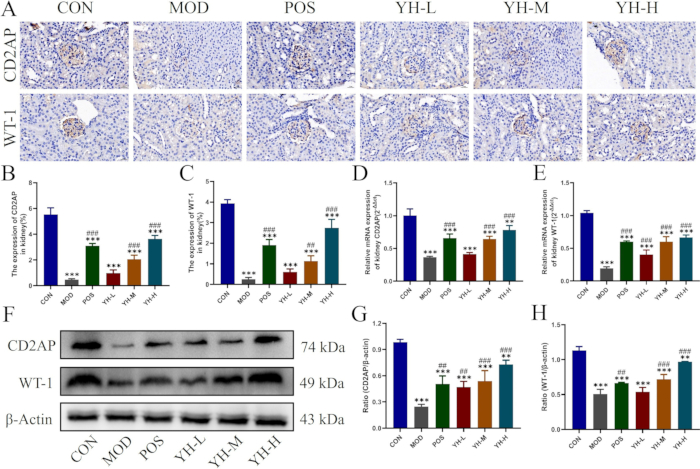 figure-results-3 Histology images, bar graphs, Western blot of CD2AP, WT-1 expression analysis in experimental study.