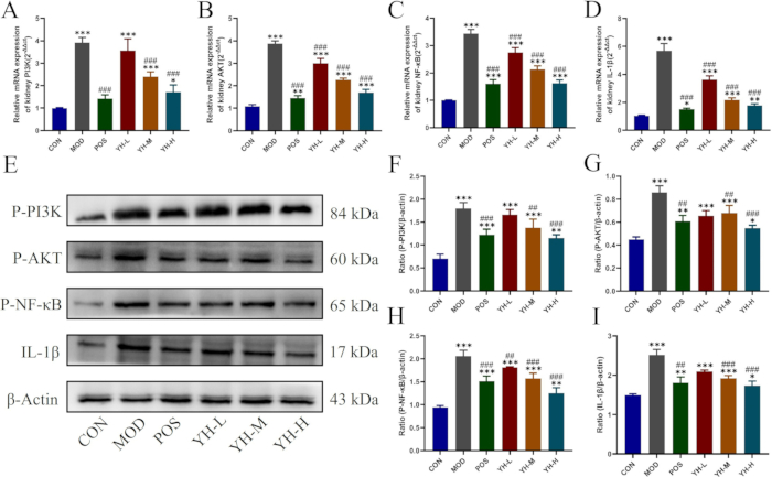 figure-results-5 Protein expression analysis, Western blot and bar graphs, showing changes in P-PI3K, P-AKT, P-NF-κB, IL-1β.