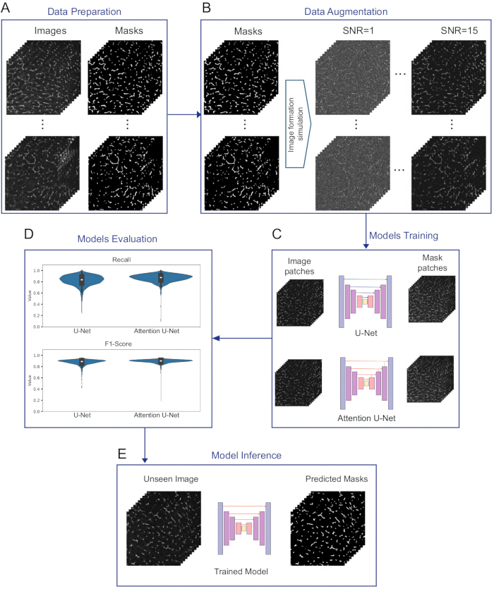 figure-results-1 Data preparation and augmentation for U-Net training; diagrams show model evaluation and inference.