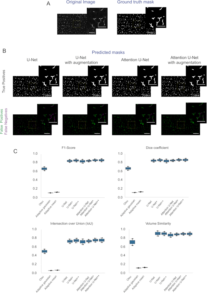 figure-results-2 U-Net segmentation comparison, predicted masks, analysis, F1-score, Dice coefficient, IoU, chart.