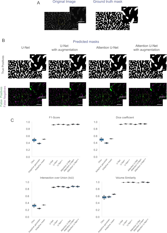figure-results-4 Deep learning segmentation; U-Net comparison; method performance charts; F1, Dice, IoU metrics.