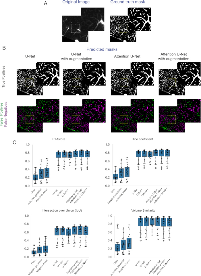 figure-results-5 Image segmentation analysis; diagram of U-Net method with augmentation; charts showing F1-Score, Dice.