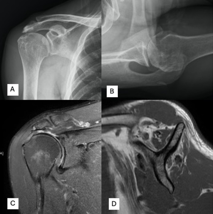 figure-results-1 Shoulder joint MRI and X-ray images, illustrating anatomical structures and comparison for diagnostics.