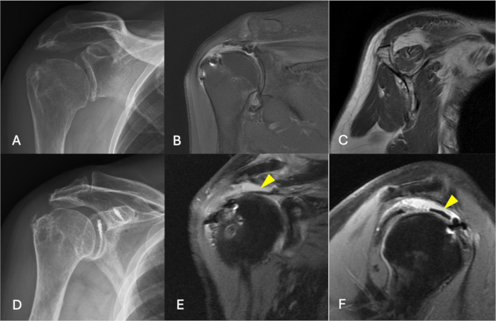 figure-results-3 Shoulder MRI and X-ray showing joint imaging techniques for medical analysis and diagnosis.