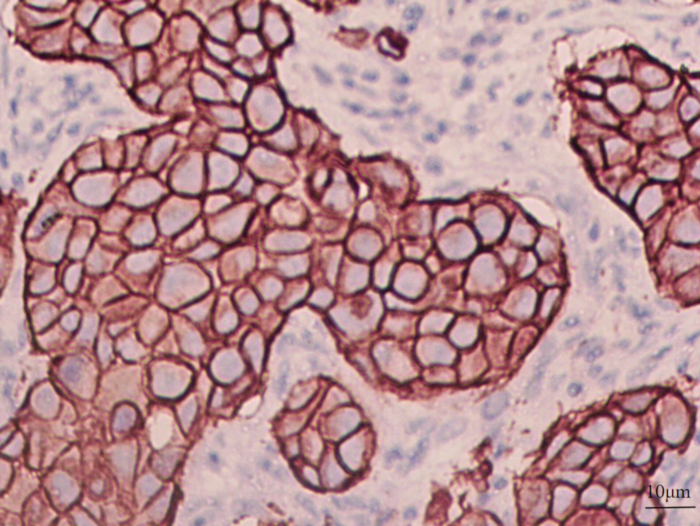 Histology tissue sections, light microscopy analysis, cell structure visualization, 10µm scale.