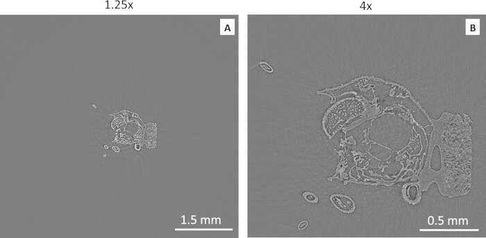 figure-results-5 Microscopy image of biological cross-section, magnified views 1.25x and 4x, cellular structure.