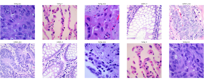 Histology microscopy images of lung, colon tissues; cellular structure, cancer research analysis.