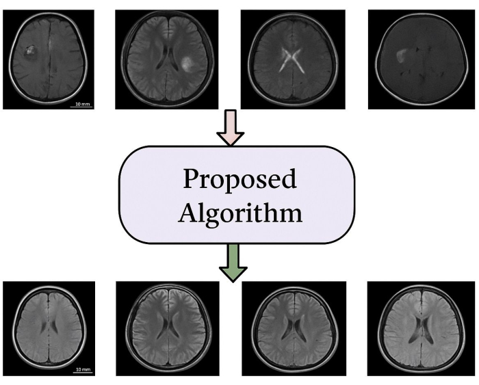 figure-protocol-8 Brain MRI analysis; algorithm processing diagram for image enhancement comparison.