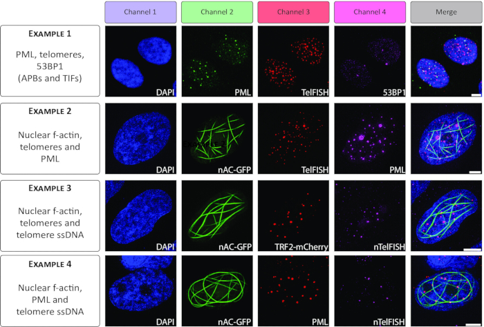 figure-results-4 Nuclear f-actin, telomeres, PML; fluorescence microscopy; cellular visualization; multichannel imaging.