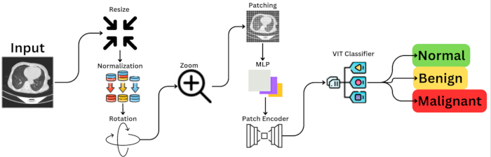 figure-protocol-1 CT image processing workflow; diagram with steps: resize, normalize, zoom, classify tumors.