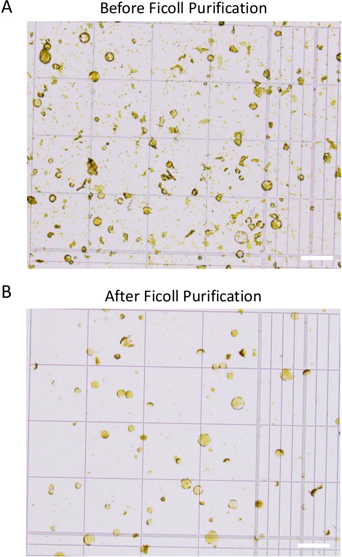 Microscope image of cell samples before and after Ficoll purification for density separation analysis.
