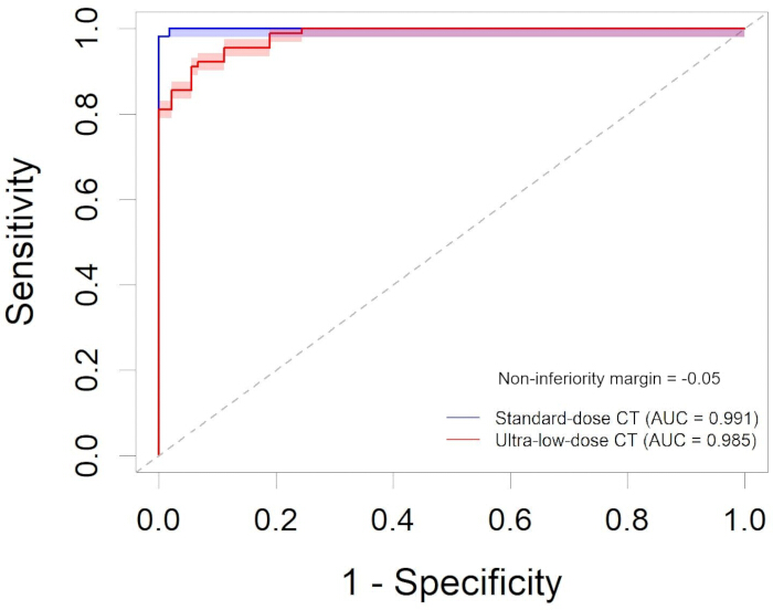 figure-results-2 ROC curve comparing standard-dose vs ultra-low-dose CT, graph, AUC=0.991 and 0.985 respectively.