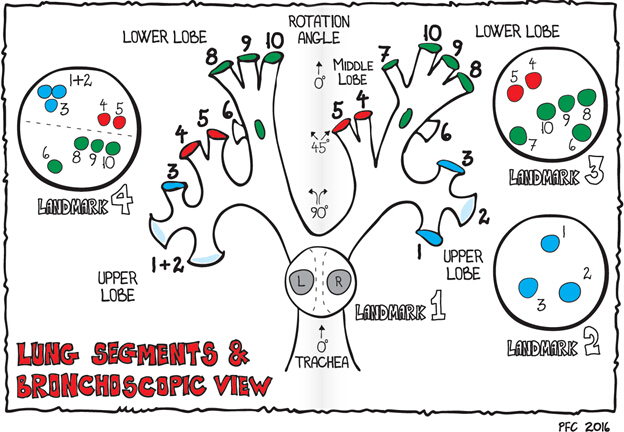 figure-protocol-1 Lung segments diagram; bronchoscopic view illustrating lobes, rotation angle, bronchial landmarks.