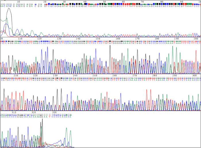 DNA sequencing chromatogram, base pair analysis, results display, genetic research, sequence data visualization.