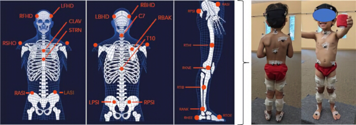 figure-protocol-2 Marker placement diagram for motion capture and child wearing sensors, gait analysis method.