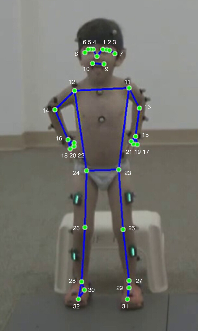 figure-protocol-3 Kinematic analysis diagram with motion capture points on child's body for gait study research.