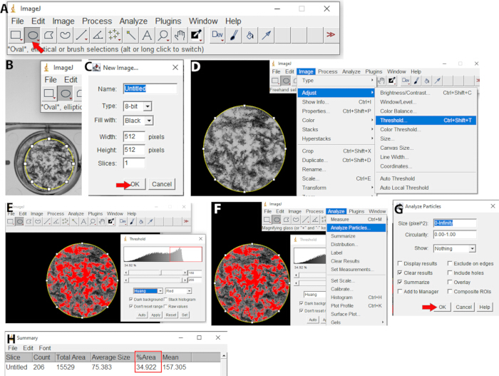 ImageJ software; image analysis, threshold adjustment, particle analysis; data extraction process.