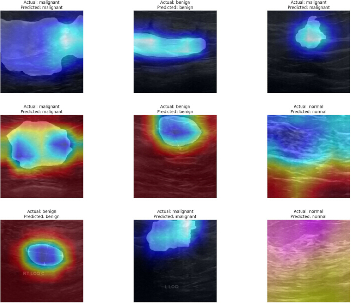figure-protocol-19 Tumor classification heatmaps, diagnosis predictions vs actual, medical diagnostic research.