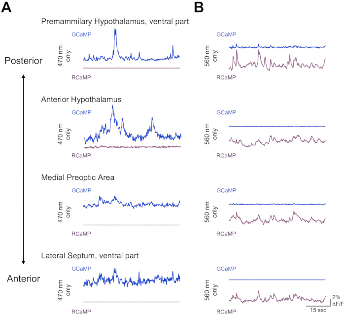 Hypothalamus GCaMP RCaMP fluorescence signals; diagram comparing 470 nm, 560 nm wavelengths.