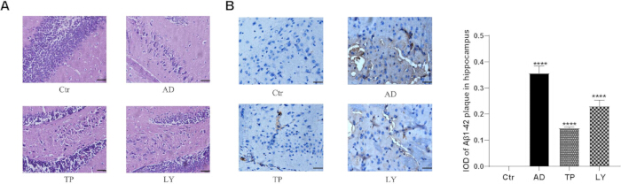 Histology diagrams show hippocampus sections and Aβ1-42 plaque analysis via imaging and bar graph.