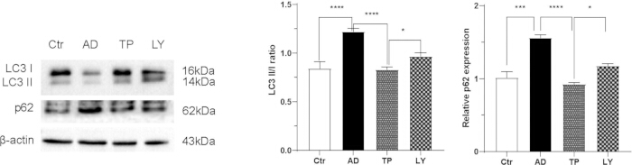 Western blot and bar chart showing LC3, p62 protein expression; relative expression analysis.