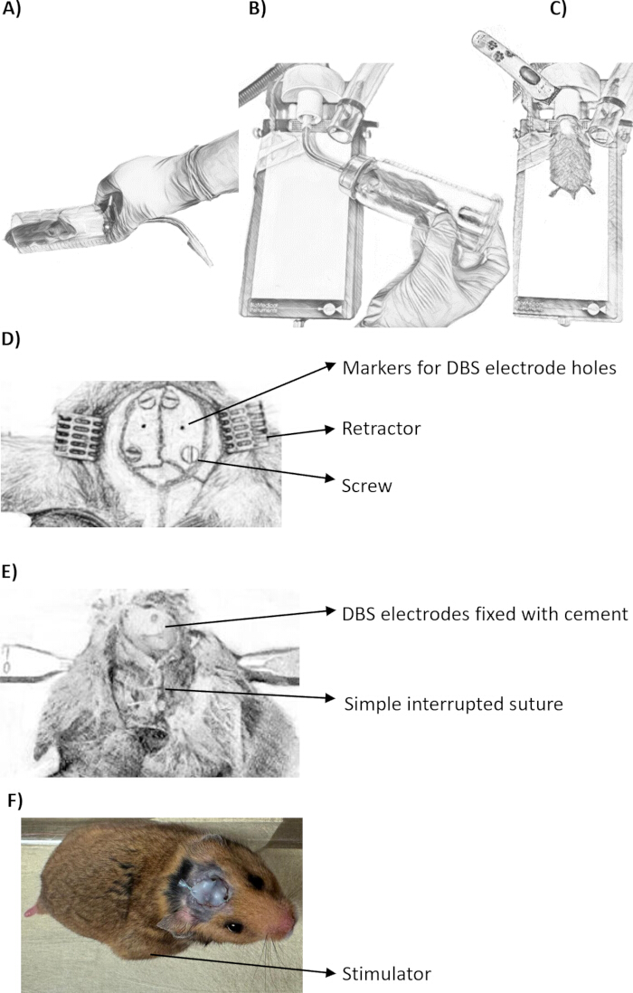 DBS surgery diagram, electrode placement, fixation with cement, interrupted suture, rat model.