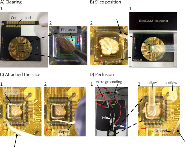 Brain slice electrophysiology setup; clearing, positioning, attachment, perfusion process diagram.