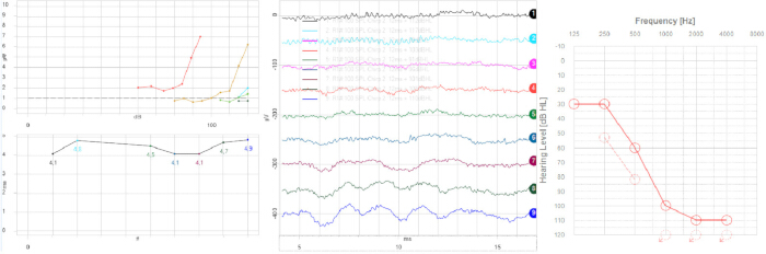 Data analysis graphs showing spectral fitting, frequency response, and signal fluctuation analysis.