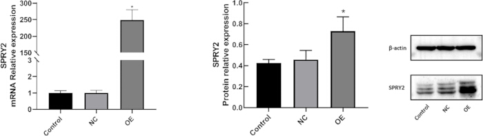 figure-results-2 mRNA and protein expression comparison; bar graphs and blot of SPRY2 vs controls; experimental results.