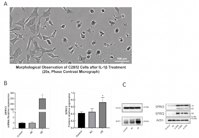 figure-results-5 Phase contrast micrograph and bar charts of C28/I2 cells, SPRY2 expression analysis, Western blot.