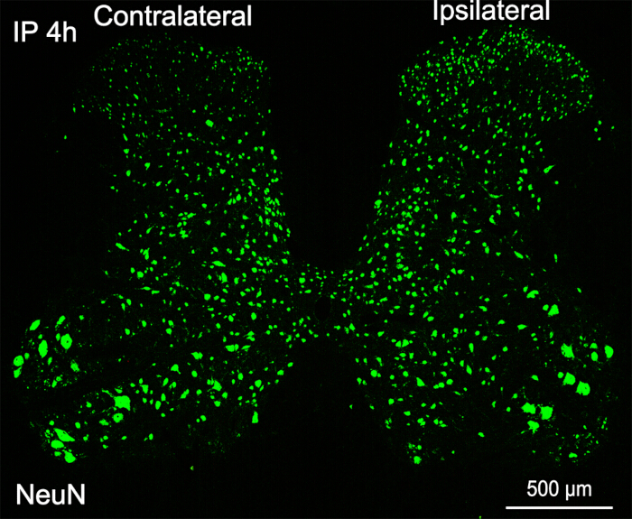 Fluorescent microscopy of NeuN-stained neural tissue, ipsilateral vs contralateral, cell distribution.