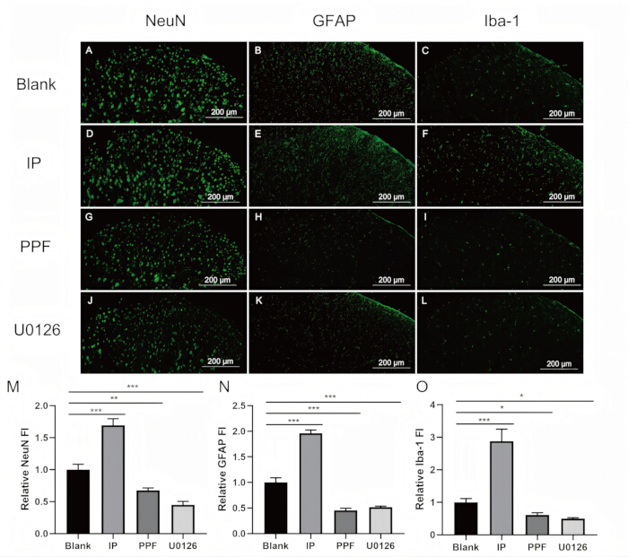 Immunofluorescence images, NeuN, GFAP, Iba-1 markers; bar graph of fluorescence intensity results.