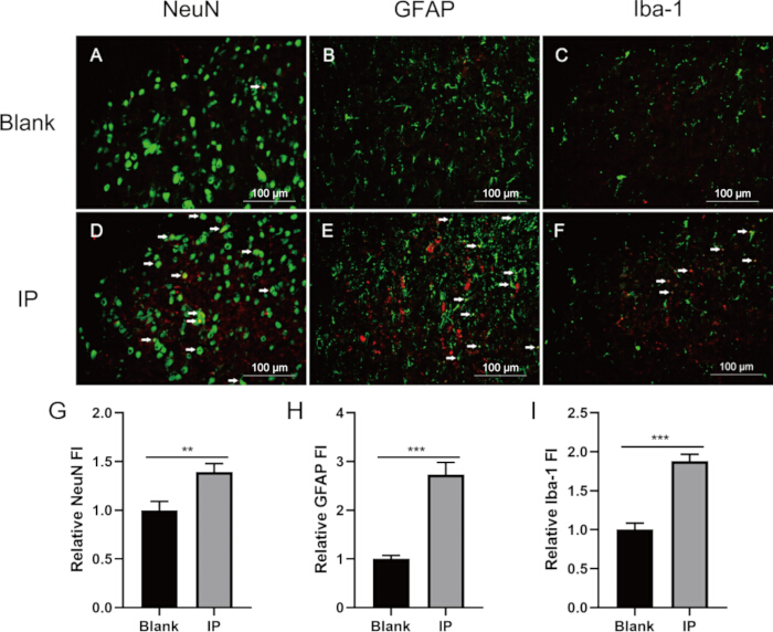 Immunofluorescence microscopy; NeuN, GFAP, Iba-1 markers; bar graph showing relative fluorescence.