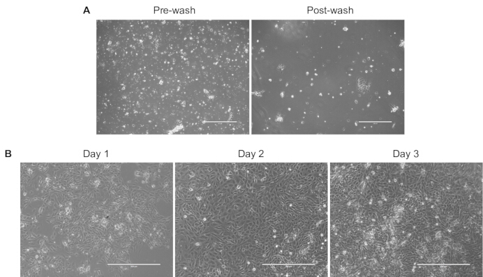 figure-protocol-3 Cell growth and wash process; microscope images pre-wash, post-wash, Day 1-3; experimental results.