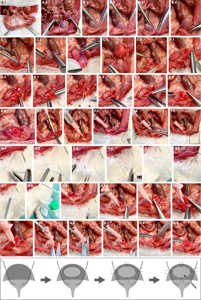 figure-protocol-1 Surgical procedure diagram for bladder augmentation, showing steps and instruments used.