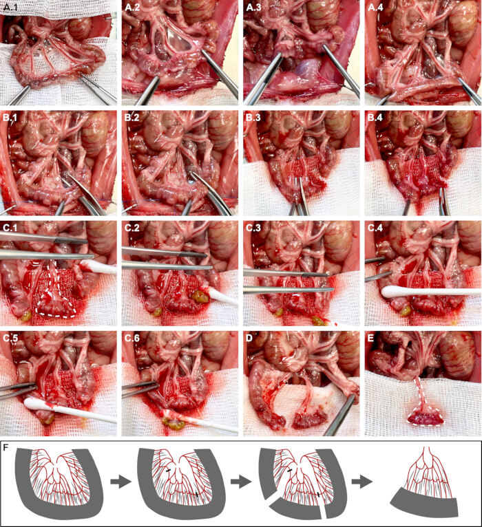 figure-protocol-2 Surgical technique progression diagram showing intestinal anastomosis procedure and suture application.