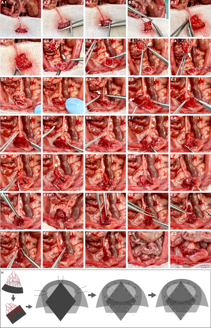 figure-protocol-3 Surgical procedure sequence with tissue sampling, intestinal sections, and schematic diagram.