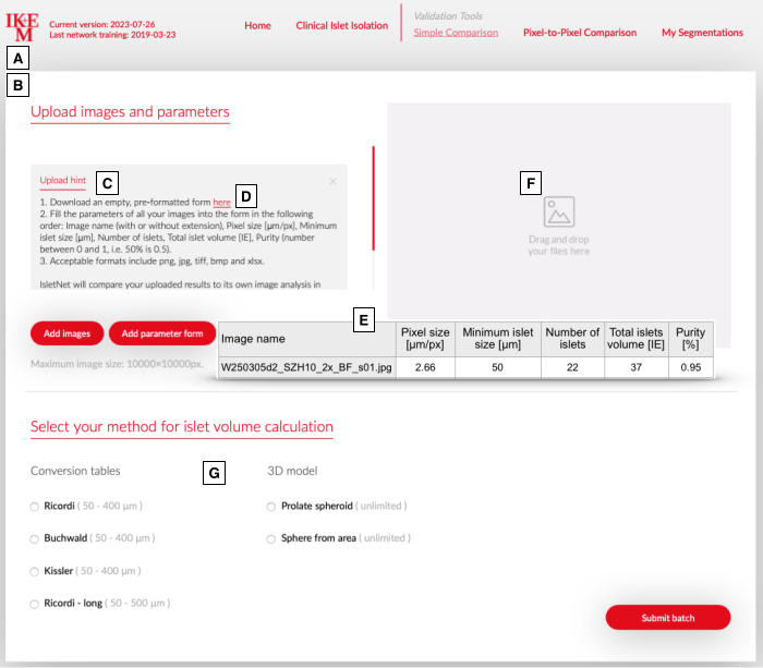 figure-protocol-3 Islet analysis interface, data input for volume calculation, diagram showing Ricordi method and 3D model options.