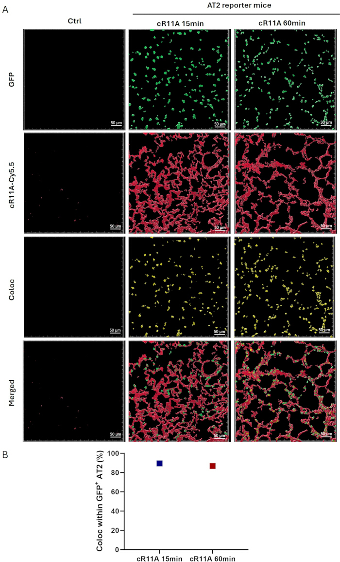 figure-results-3 Fluorescence microscopy of GFP+ AT2 cells with cR11A-Cy5.5 colocalization in AT2 reporter mice.